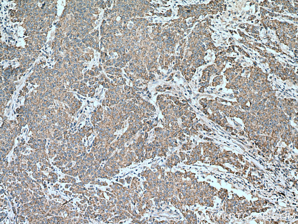 MMP17 Polyclonal antibody