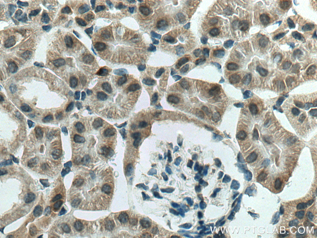 SGK1 Polyclonal antibody