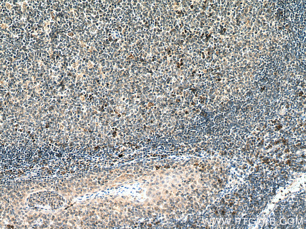 IL-15 Polyclonal antibody