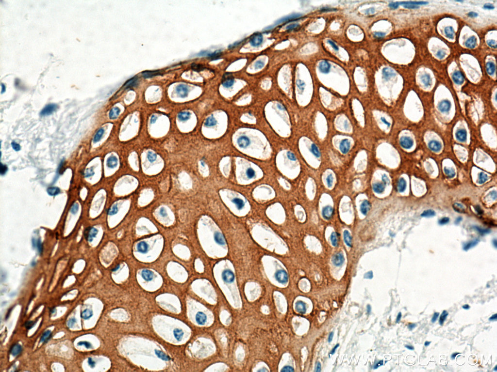 Collagen Type II Polyclonal antibody