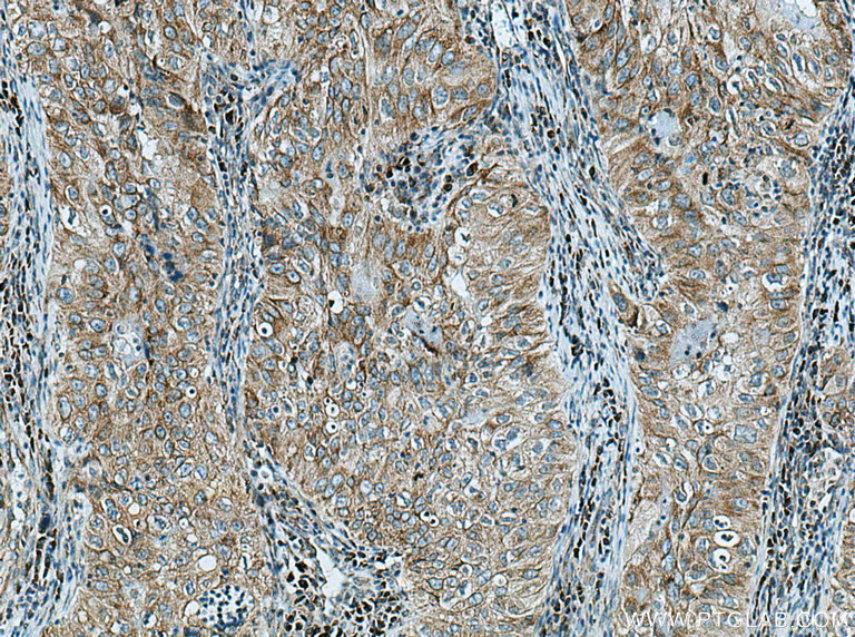 GRP Polyclonal antibody