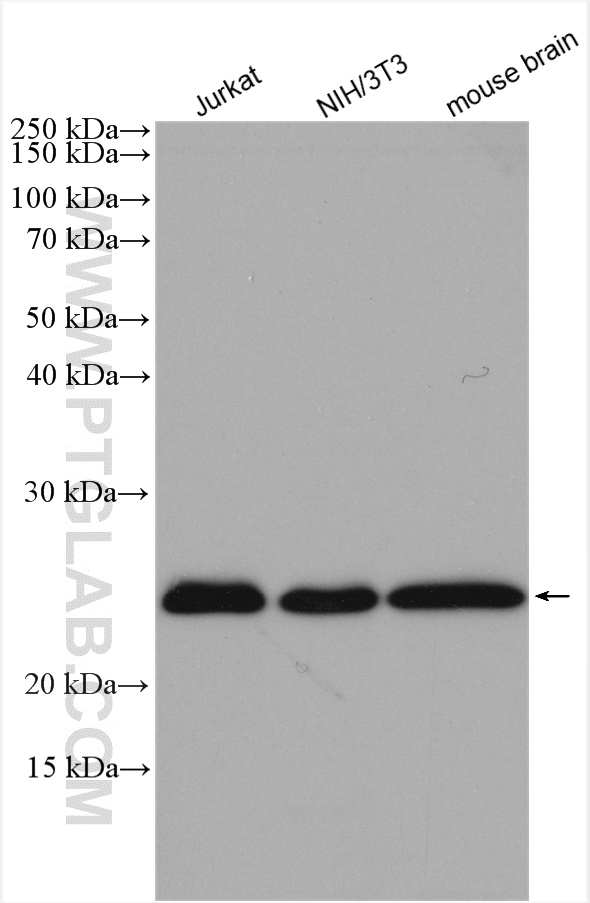 RAB11B Polyclonal antibody