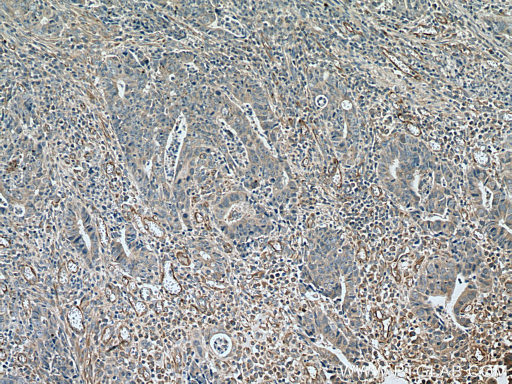 TYRO3 Polyclonal antibody