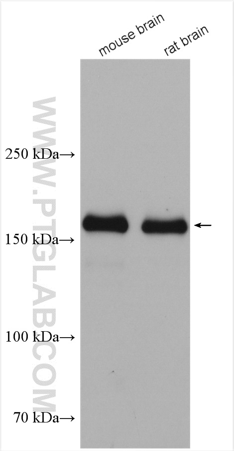 NMDAR2A/GRIN2A Polyclonal antibody