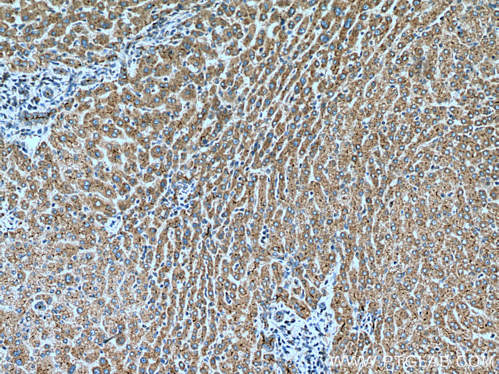 IGF1 Polyclonal antibody