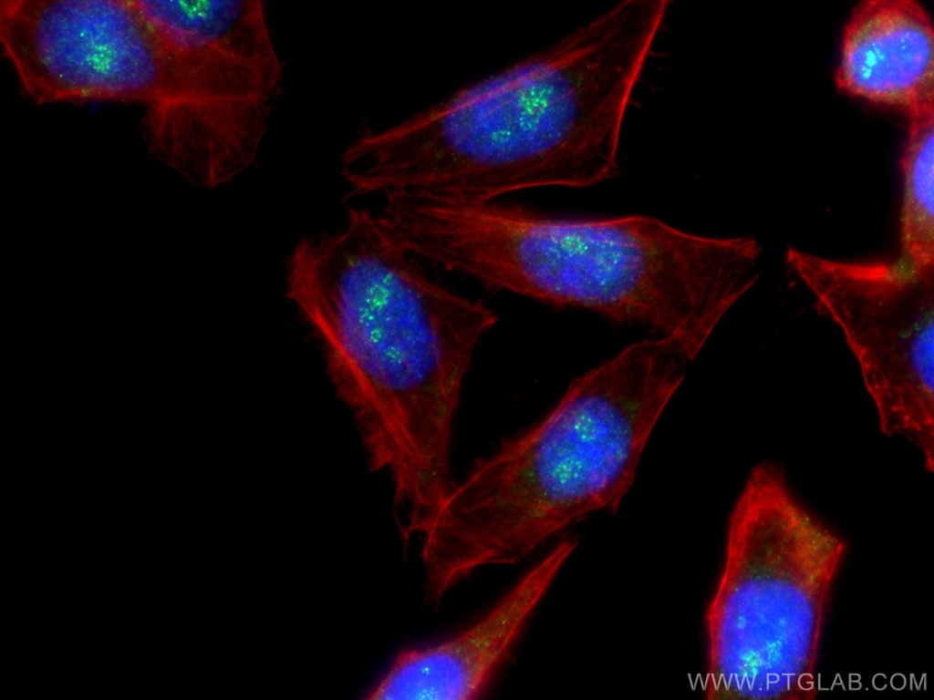 LEF1 Polyclonal antibody