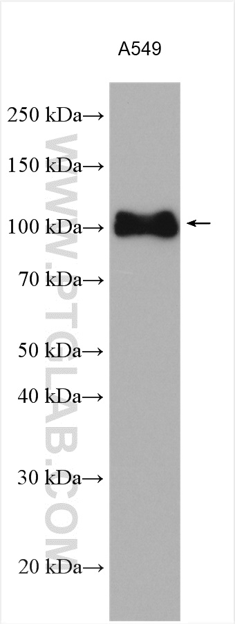 Integrin Beta 5 Polyclonal antibody