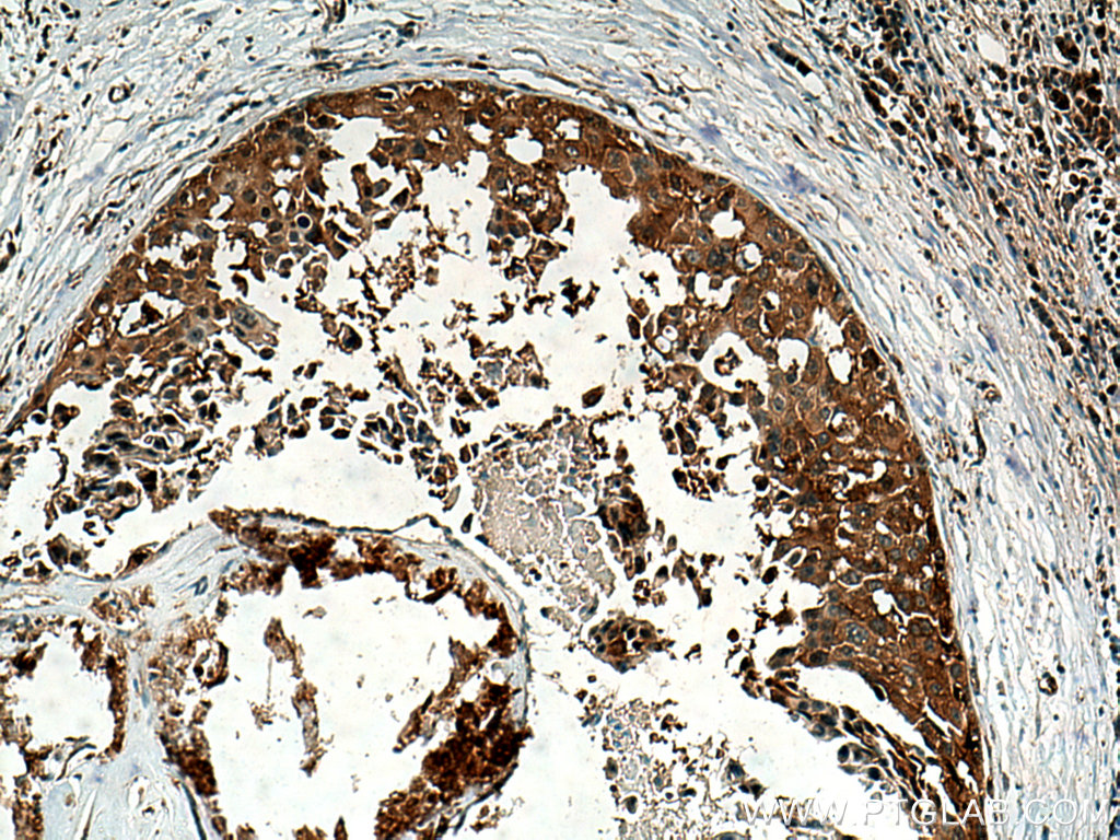ABCE1 Polyclonal antibody