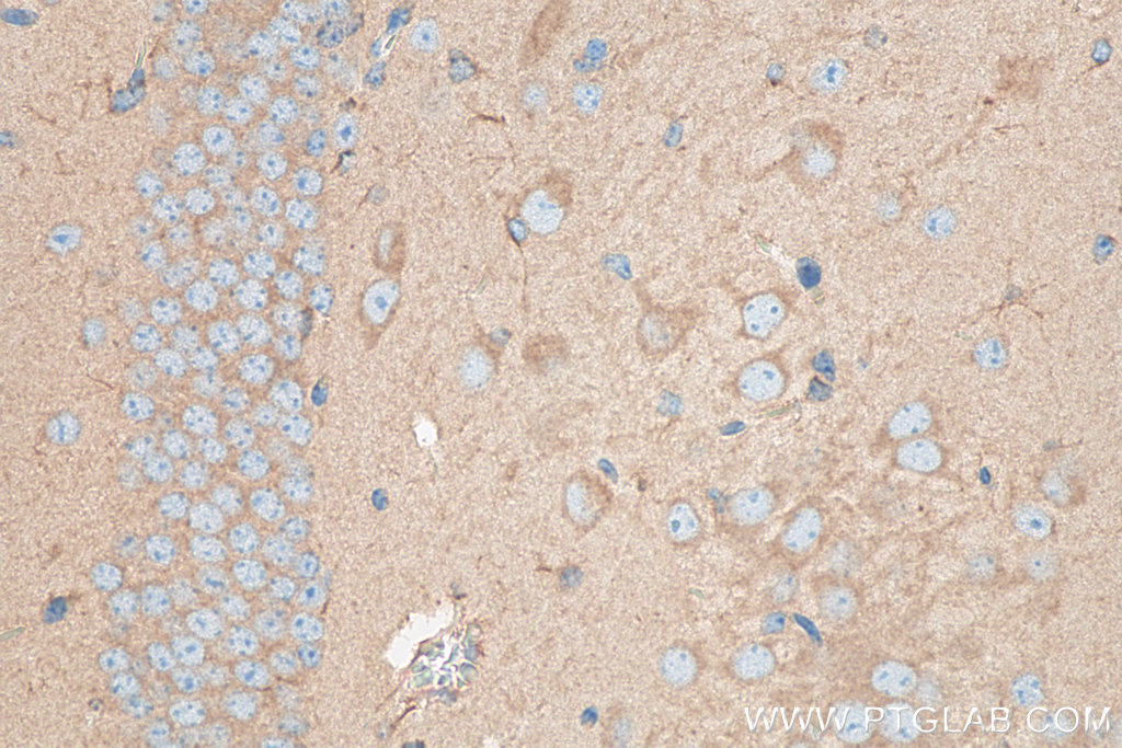 PICALM Polyclonal antibody