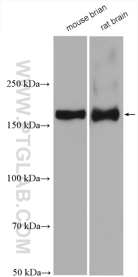 NMDAR2A/GRIN2A Polyclonal antibody