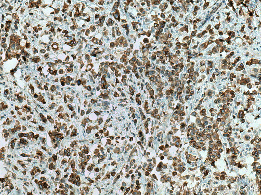 PTPLAD1 Polyclonal antibody