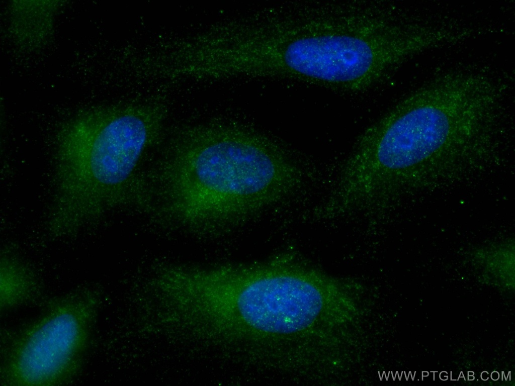 TRIM59 Polyclonal antibody