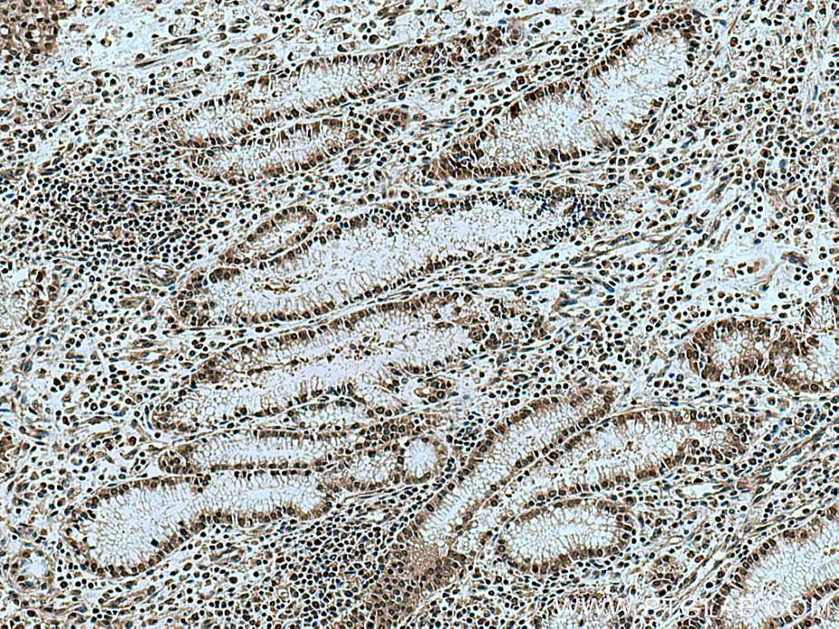 KIF23 Polyclonal antibody