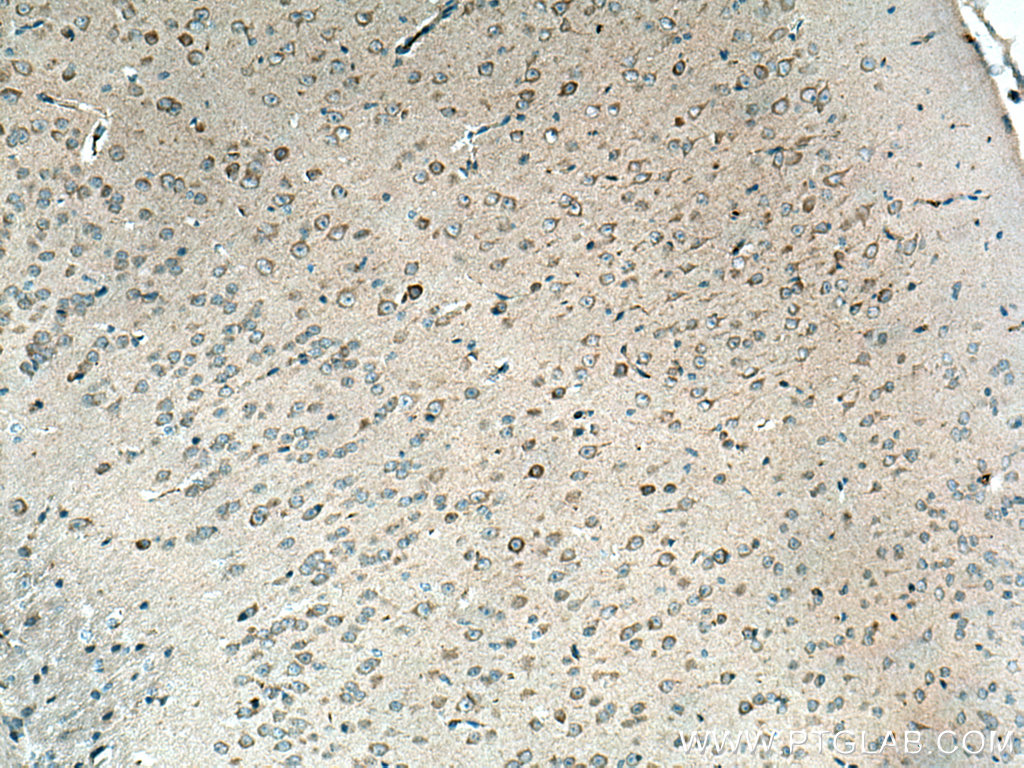 TAC1 Polyclonal antibody