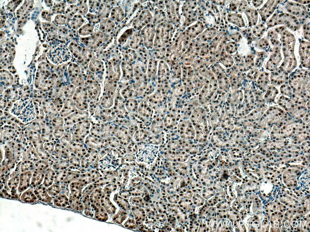 ZBTB8OS Polyclonal antibody