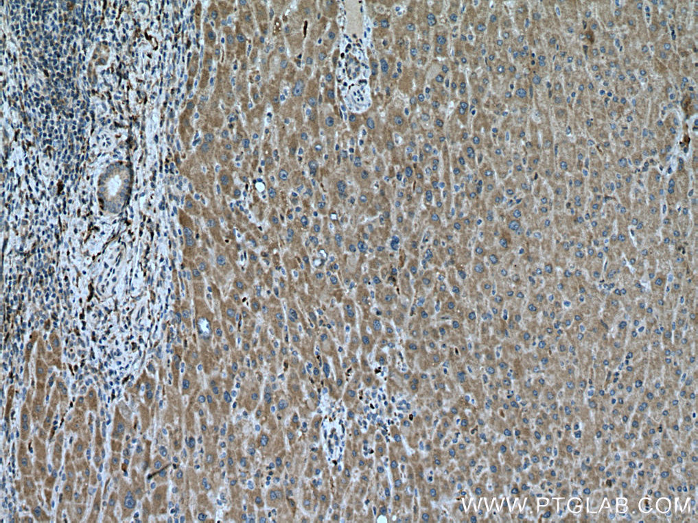 BCAT1 Polyclonal antibody