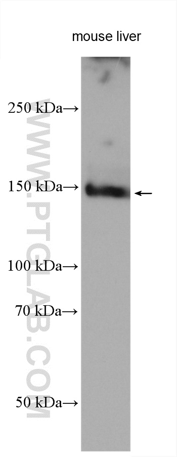 C15orf55 Polyclonal antibody