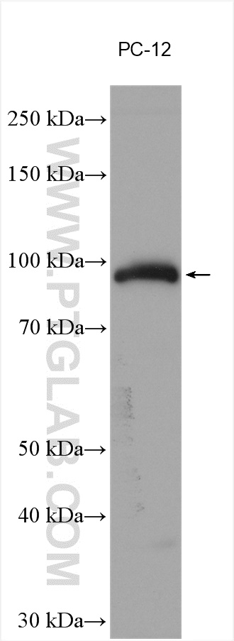 Chromogranin B Polyclonal antibody