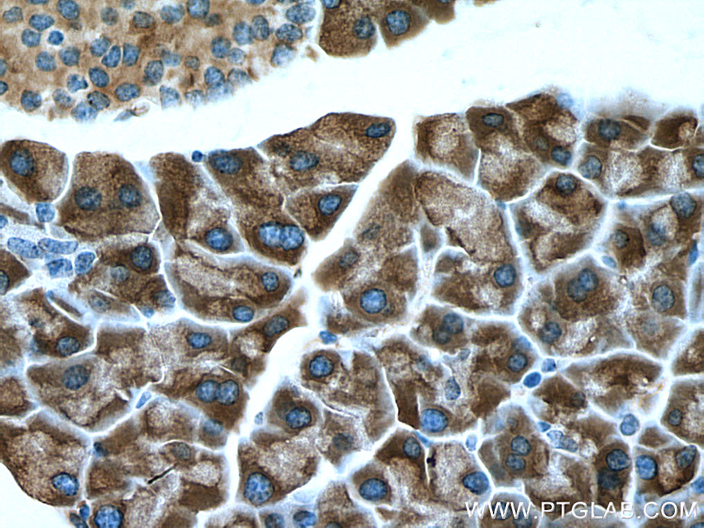 SEC63 Polyclonal antibody
