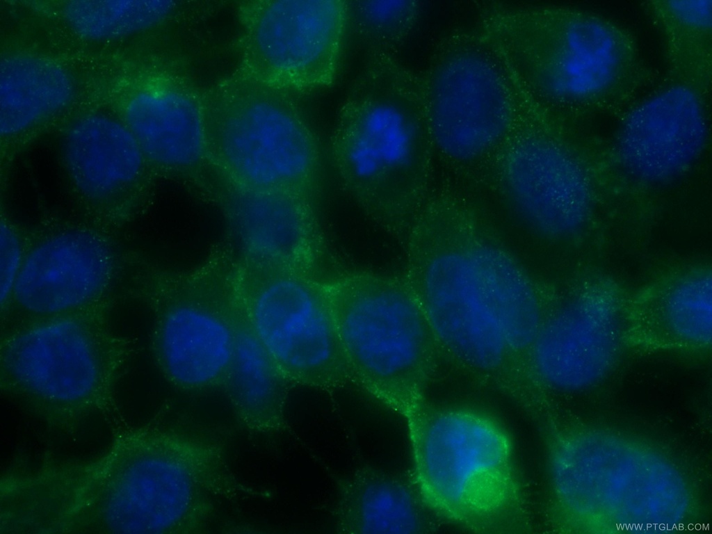 Claudin 1 Polyclonal antibody