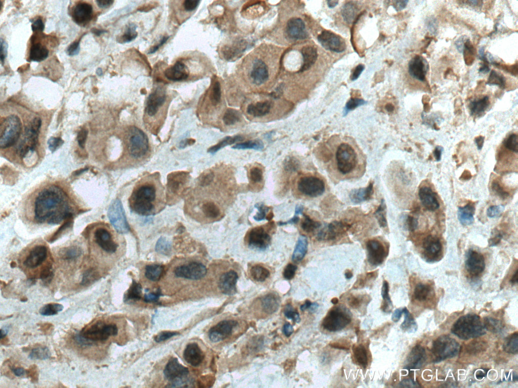 WWP1 Polyclonal antibody