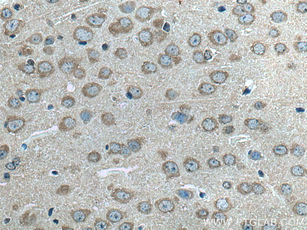 ALG13 Polyclonal antibody