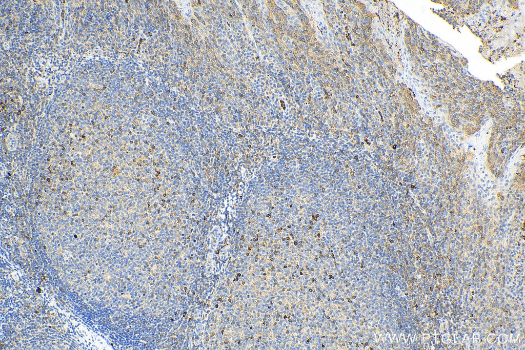 TNFR2 Polyclonal antibody