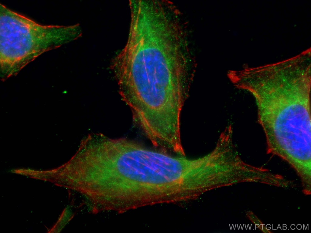 PLK4 Polyclonal antibody