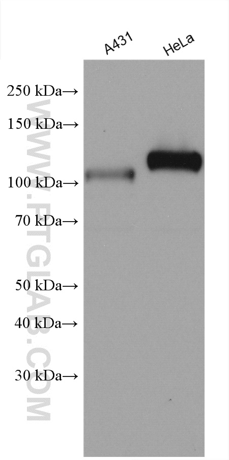 KAT2B Polyclonal antibody