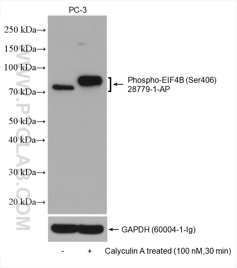 Phospho-EIF4B (Ser406) Polyclonal antibody