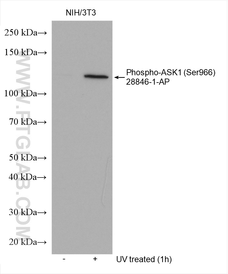 Phospho-ASK1 (Ser966) Polyclonal antibody