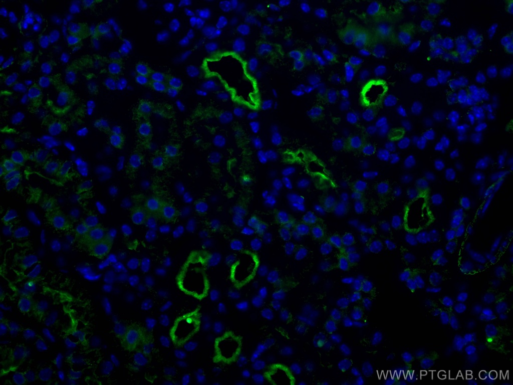 ACE2 Polyclonal antibody