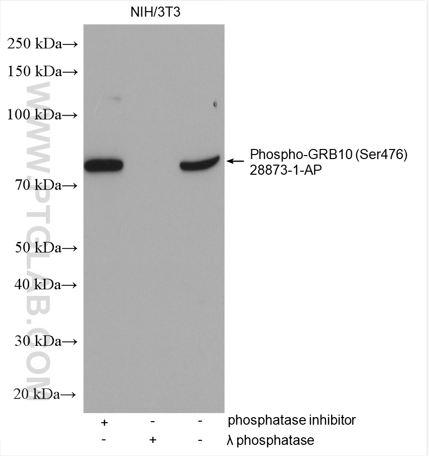 Phospho-GRB10 (Ser476) Polyclonal antibody