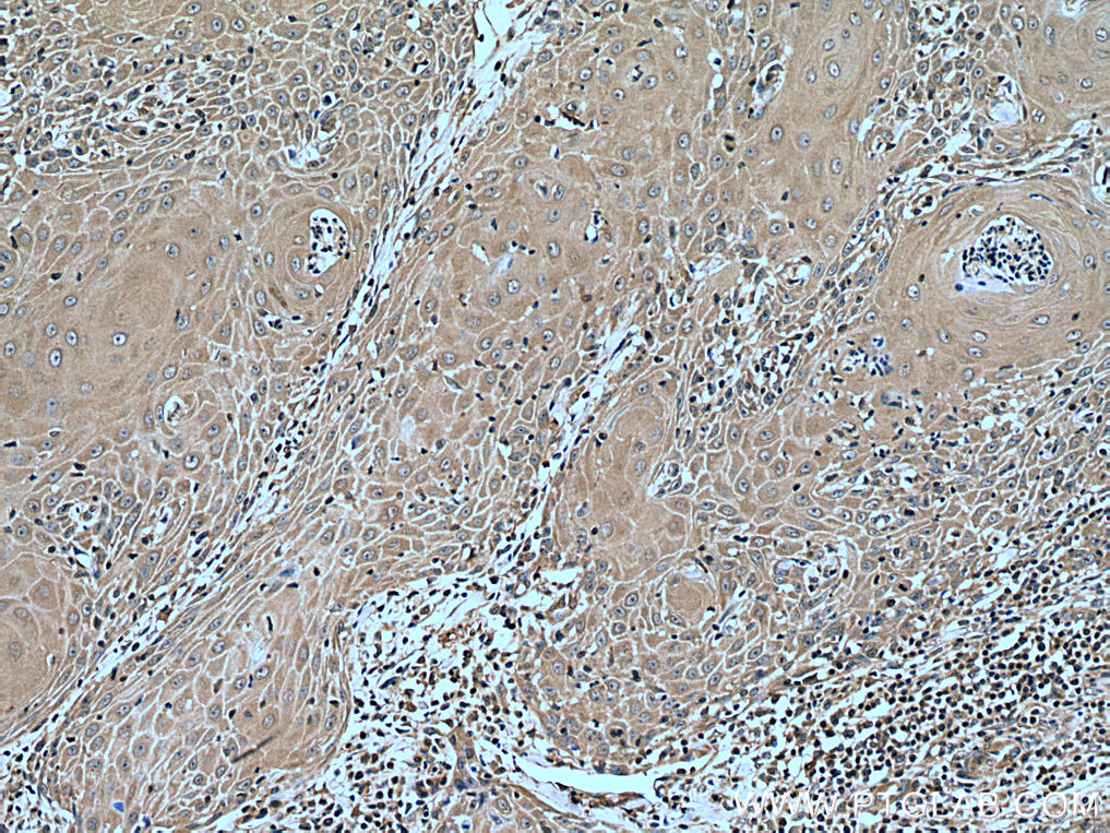 CORO2A Polyclonal antibody