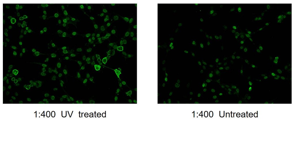 Phospho-JUN (Ser73) Polyclonal antibody