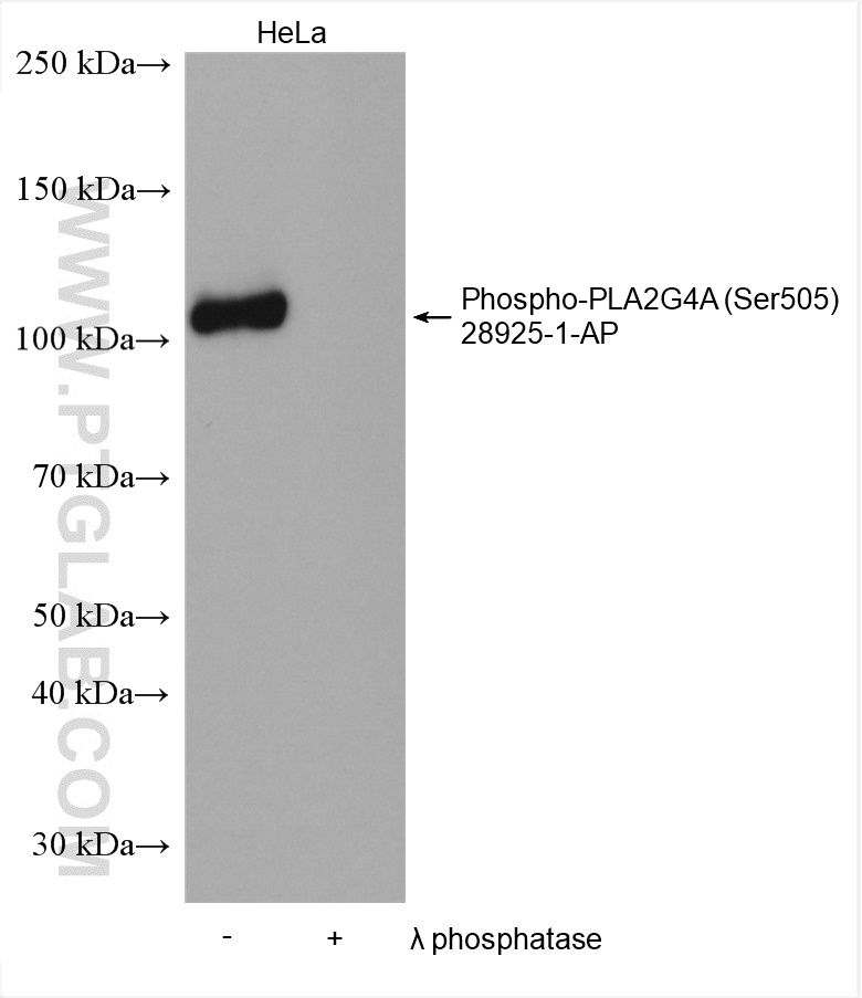 Phospho-PLA2G4A (Ser505) Polyclonal antibody