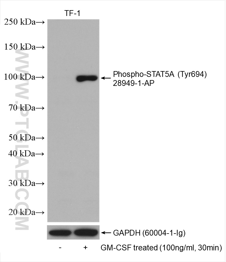 Phospho-STAT5A (Tyr694) Polyclonal antibody