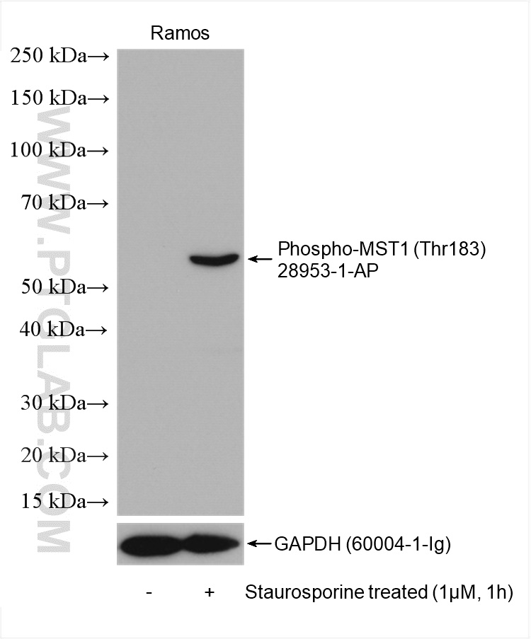 Phospho-STK4 (Thr183) Polyclonal antibody