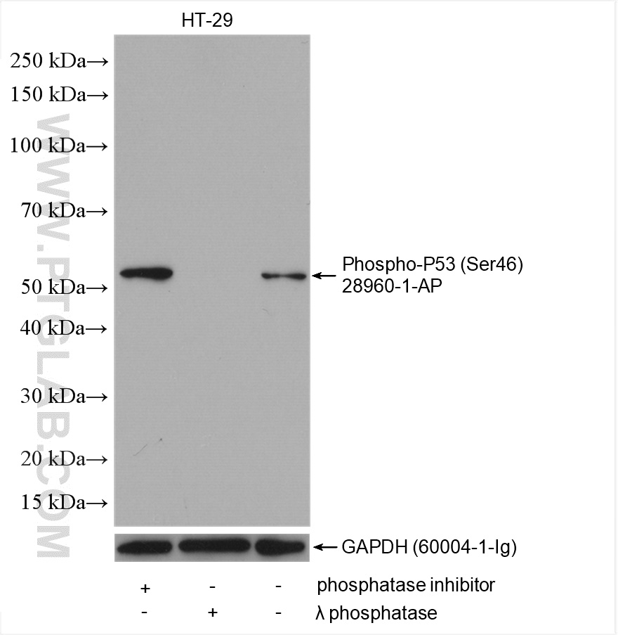 Phospho-P53 (Ser46) Polyclonal antibody
