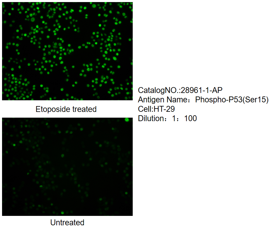 Phospho-P53 (Ser15) Polyclonal antibody