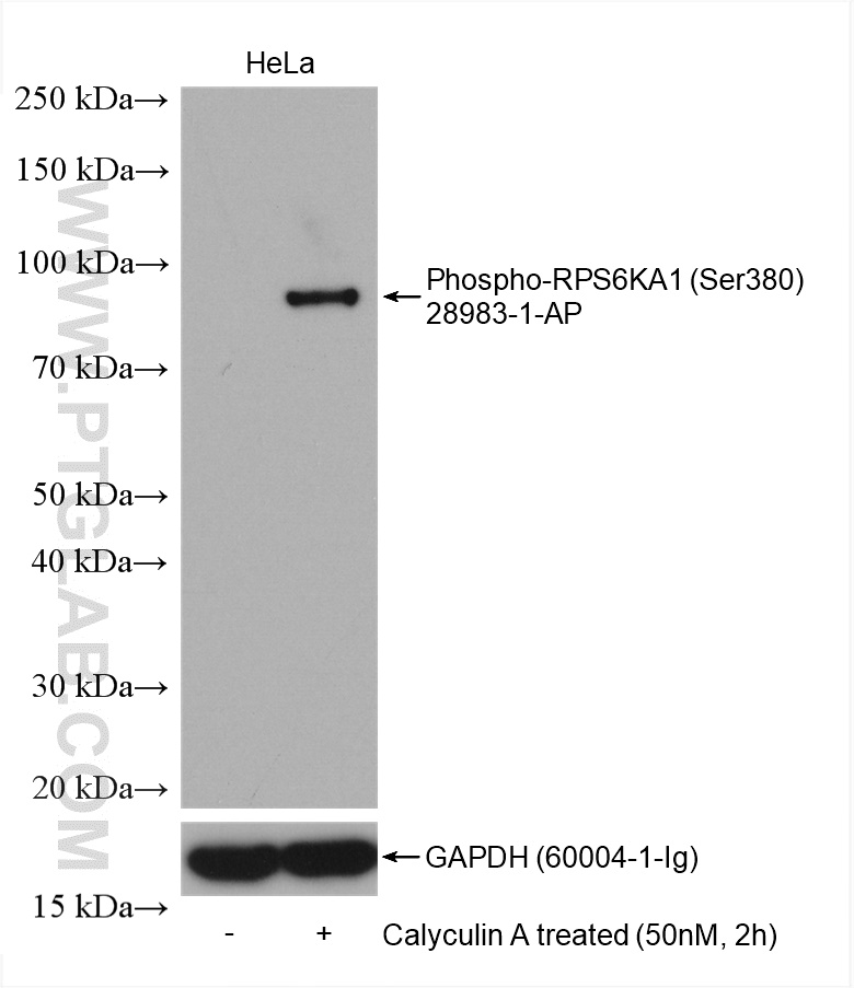 Phospho-RPS6KA1 (Ser380) Polyclonal antibody