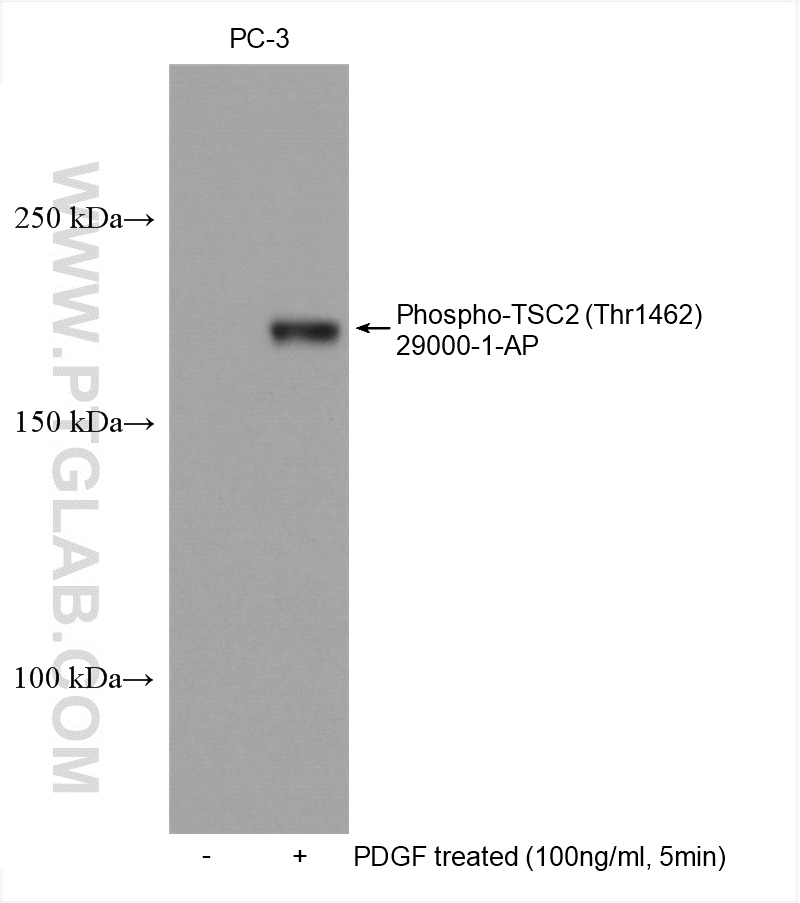 Phospho-TSC2 (Thr1462) Polyclonal antibody