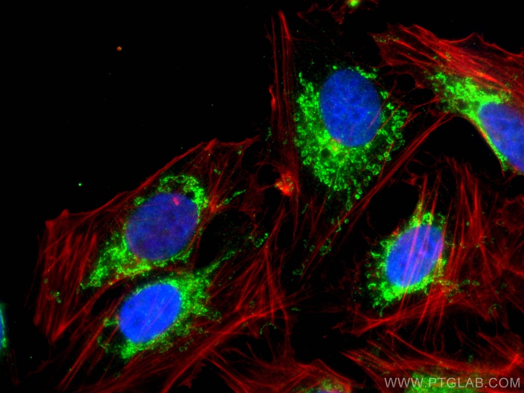 TRMT10C Polyclonal antibody