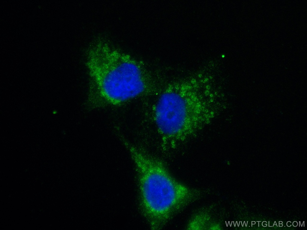 MMP14 Polyclonal antibody