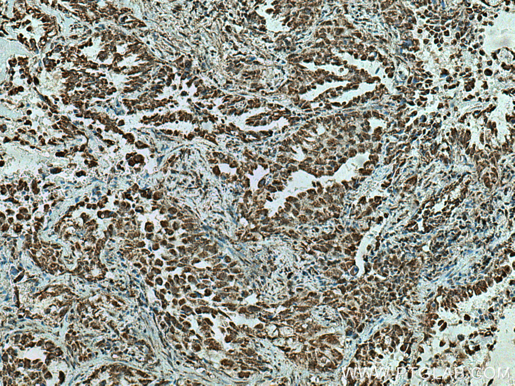 CBLL1 Polyclonal antibody