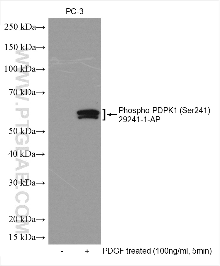 Phospho-PDPK1 (Ser241) Polyclonal antibody