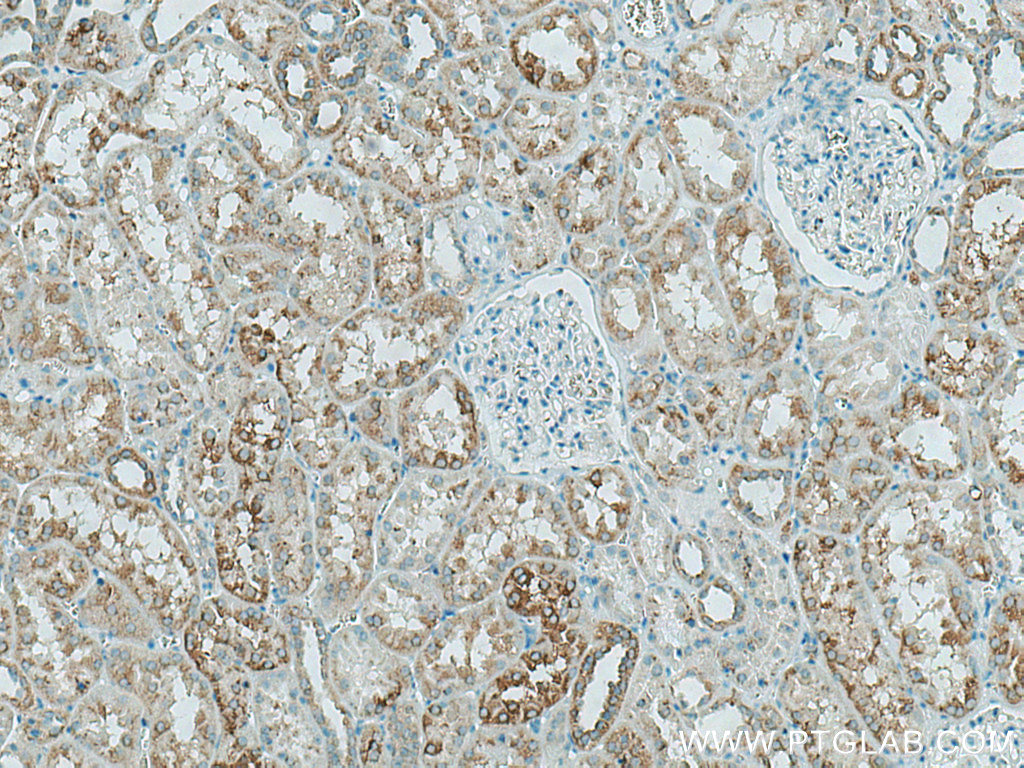 HEXA Polyclonal antibody