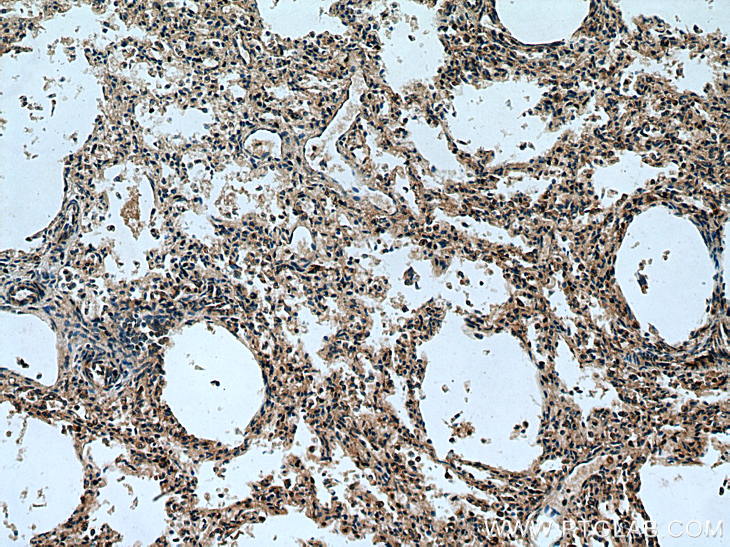 TMEM41B Polyclonal antibody