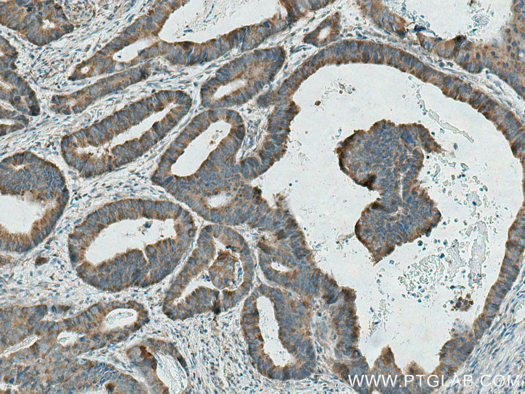 GAB2 Polyclonal antibody