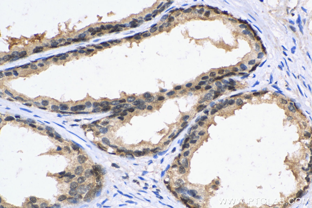 PCNP Polyclonal antibody